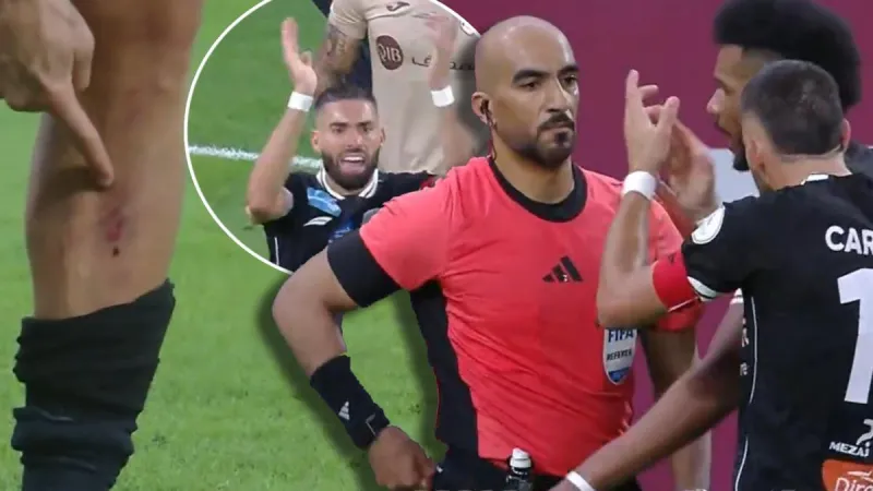 Casi rompen la pierna a Yannick Carrasco... ¡y le sacan la roja al ex del Atlético!