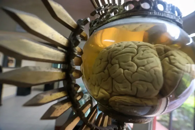 Conoce por qué el Museo del Cerebro del Perú atrae a científicos del mundo [video]