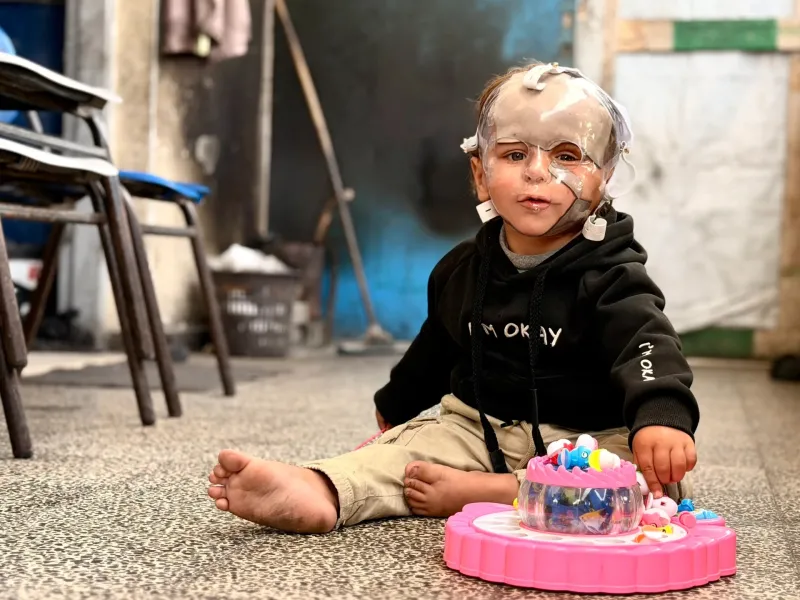 Born during Israel’s genocide: Gaza’s child survivors bear the scars of war
