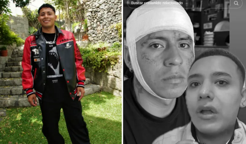 Streamer Ángel Ramírez sufre golpiza en discoteca y termina herido tras corte en la frente