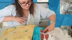 El esperanzador ensayo pionero sobre la preeclampsia, la complicación del embarazo que mata a medio millón de bebés al año