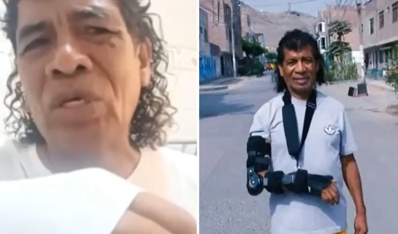 Cómico ‘Cachay’ revela delicado estado de salud tras fuerte agresión en pleno show: “Se me han abierto los huesos”