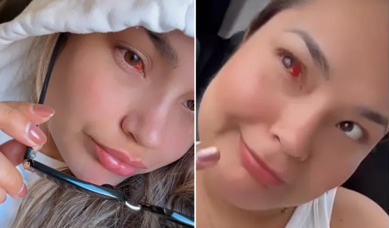 Lesly Águila aparece con aparente problema en los ojos: imágenes preocupan a los fans de Corazón Serrano