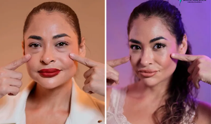 Melanie Martínez impacta al mostrar su nuevo rostro tras someterse a cirugía estética: “Gracias por devolverme la juventud”
