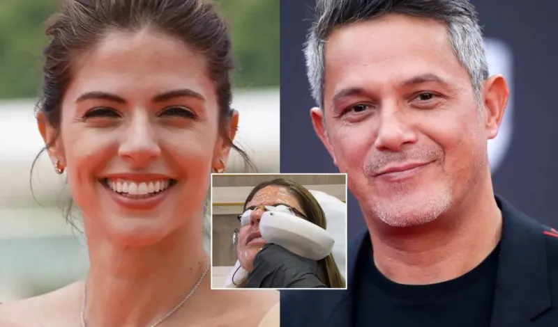 Stephanie Cayo impacta con tratamiento estético en el rostro para lucir más joven en medio de romance con Alejandro Sanz