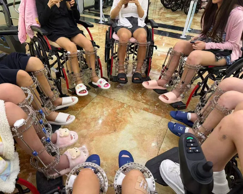 Romperse las piernas para ser más alta: el negocio clandestino que atrapa a miles de jóvenes chinas