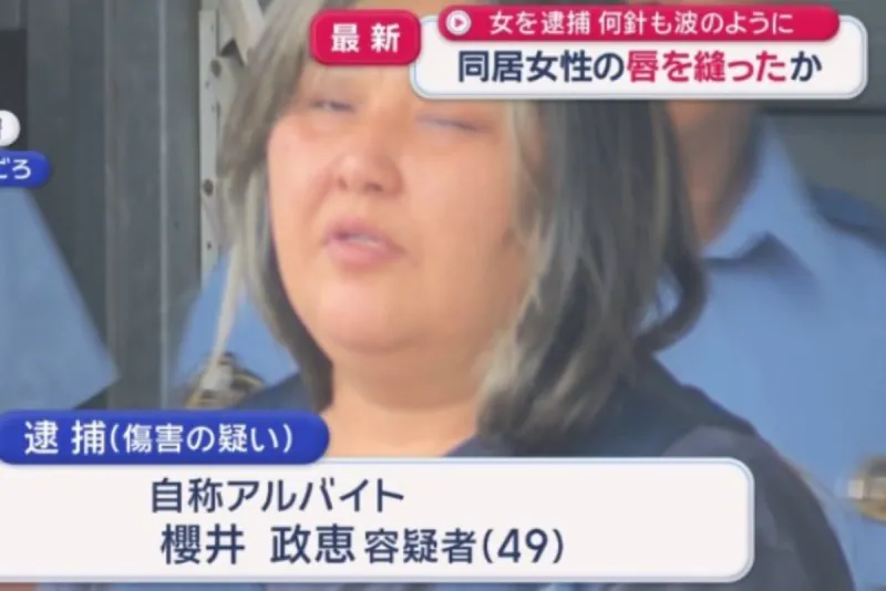 Detienen a una mujer en Japón por coser los labios a su compañera de piso
