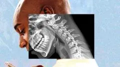"Cuerpo de teléfono": cómo la tecnología nos arruga el cuello y debilita las manos