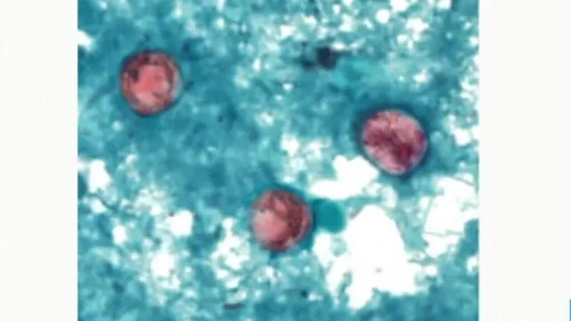 Estados Unidos investiga un brote de ciclosporiasis vinculado a una lechuga mexicana